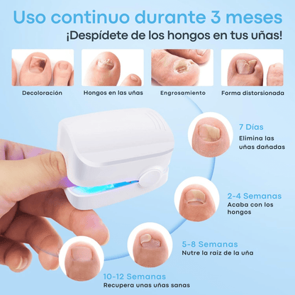Láser para Hongos en Uñas de Pies y Manos | Dispositivo Antifúngico LED e Infrarrojo | Elimina Hongos Rápido, Sin Dolor y en Casa | Portátil, Recargable y Seguro - Homanage