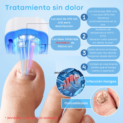 Láser para Hongos en Uñas de Pies y Manos | Dispositivo Antifúngico LED e Infrarrojo | Elimina Hongos Rápido, Sin Dolor y en Casa | Portátil, Recargable y Seguro - Homanage